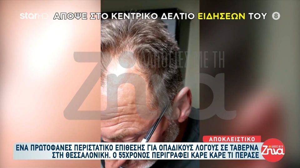 Πρωτοφανές περιστατικό οπαδικής επίθεσης σε  55χρονο σε ταβέρνα: Με έριξαν κάτω και με χτυπούσαν 20 άτομα  με δολοφονικό τρόπο…