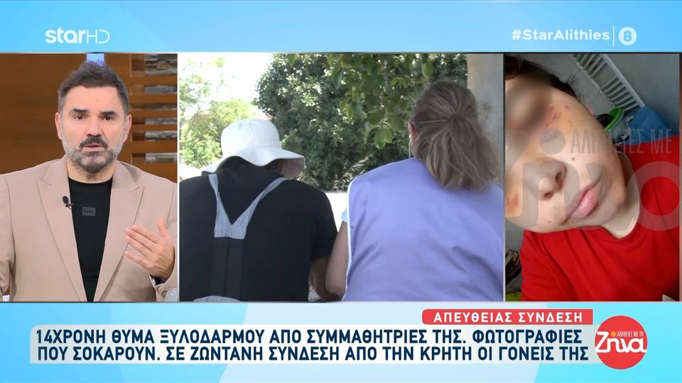 Κρήτη: 14χρονη θύμα ξυλοδαρμού από συμμαθήτριές της – Σοκάρουν οι φωτογραφίες